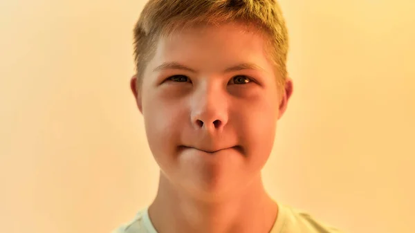 Nahaufnahme Porträt eines lebenslustigen behinderten Jungen mit Down-Syndrom, der komische Gesichter macht, während er isoliert vor gelbem Hintergrund posiert — Stockfoto