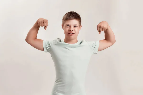 Cheerful disabled boy with Down syndrome looking at camera, raising his arms, showing his strength while standing isolated over white background — Stock Photo, Image