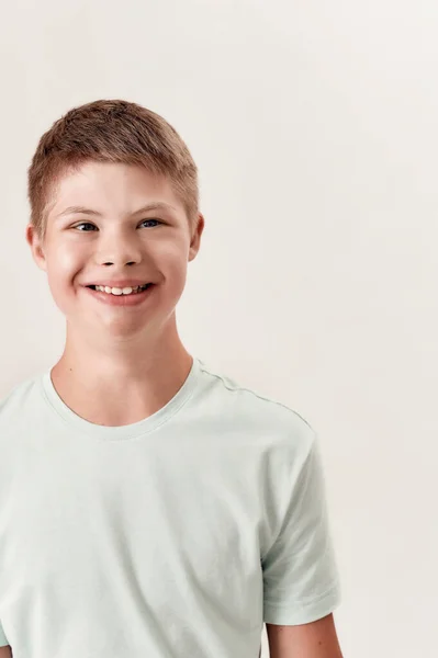 Retrato de niño alegre discapacitado con síndrome de Down sonriendo a un lado mientras posa aislado sobre fondo blanco — Foto de Stock