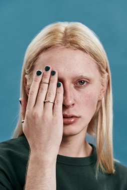 Genç beyaz adam manikürlü elleriyle gözlerini kapatıyor.