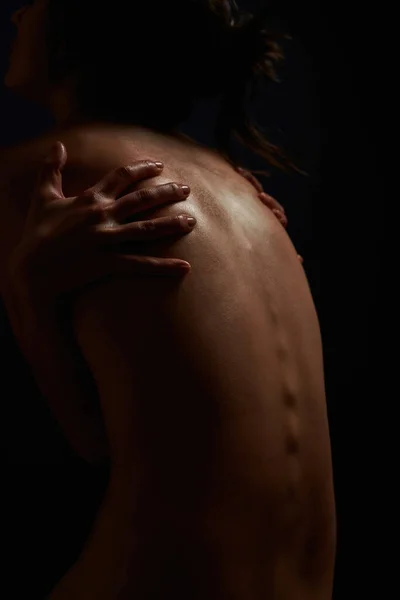 Pandangan terselubung tentang telanjang belakang wanita muda menyentuh tubuhnya, berpose terisolasi dalam kegelapan — Stok Foto