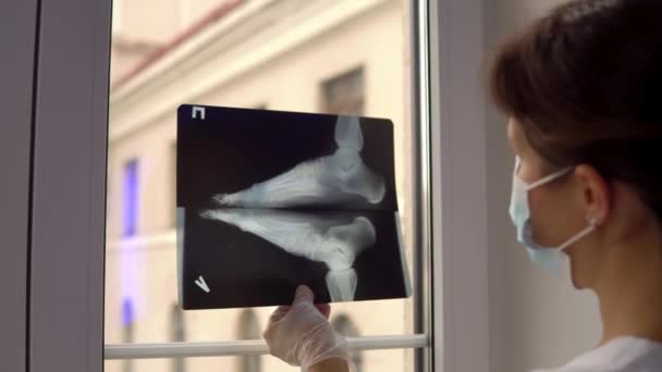 Doktor kırık ayağın röntgen filmini inceliyor. — Stok video