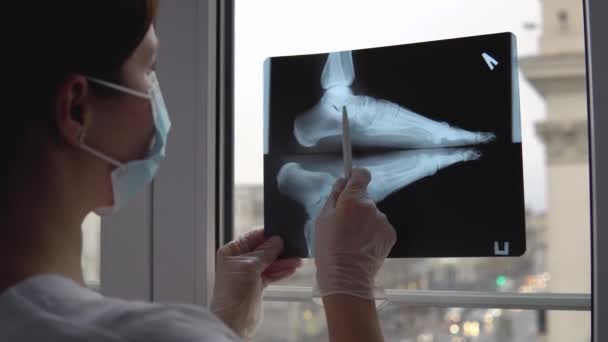 Arzt untersucht Röntgenfilm des gebrochenen Fußes — Stockvideo