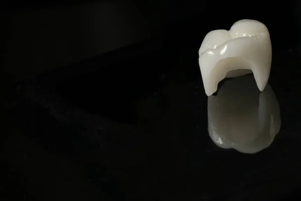 Keramická Koruna Zub — Stock fotografie