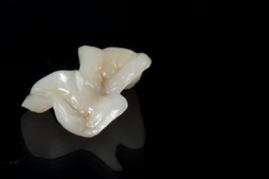 emax seramik onlay üzerinde siyah arkaplan