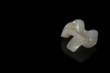 emax seramik onlay üzerinde siyah arkaplan