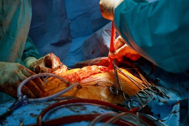 Sıhhiye cerrahının elleri hastanede geçirdiği bir ameliyattan sonra bir yarayı dikiyor.