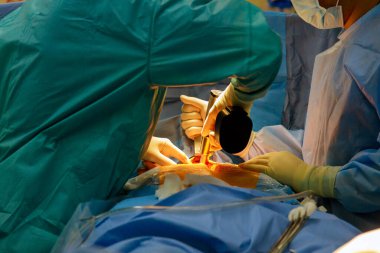 Açık kalp ameliyatı sırasında cerrahi aletle kendilerini yaranın içinde ameliyat ederler.