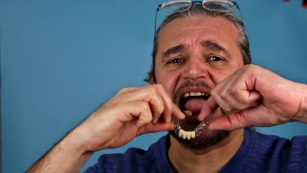 Μανς χέρι βάζοντας οδοντιατρικές κορώνες στα δόντια — Αρχείο Βίντεο