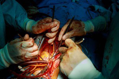 Sıhhiye cerrahının elleri hastanede geçirdiği bir ameliyattan sonra bir yarayı dikiyor.