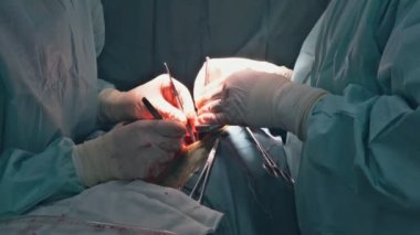 Cerrahlar, hastalara ameliyat yapan sağlık görevlilerinin üzerinde duruyorlar.