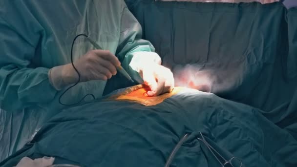 Betegműtő a sebészeti beavatkozás megkezdéséhez, a munkájuk során bevágással — Stock videók