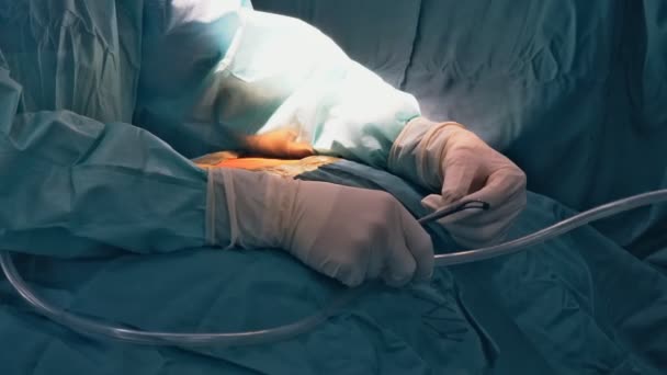 Förberedelsepatient för kirurgiskt ingrepp med skärsår — Stockvideo