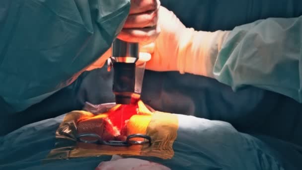 Patient of surgery in doctor during their work operating room for the beginning of surgical operation — Vídeo de stock