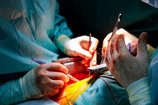 Χειρουργός Στο Χειρουργείο Κατά Διάρκεια Της Επέμβασης Χρήση Χειρουργικού Εξοπλισμού — Φωτογραφία Αρχείου