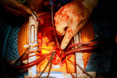 İki cerrah ameliyat sırasında kalp üzerinde çalışır. Ameliyathane içinde elleri titizdir..