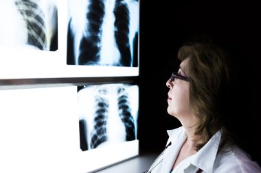 kadın doktor kontrol xray görüntü