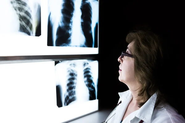 Médico feminino verificando imagem de raio-x — Fotografia de Stock