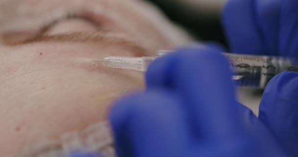 Cosmeticianul care face injecție de colagen — Videoclip de stoc