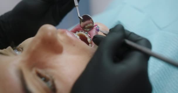 Unerkennbarer Zahnarzt untersucht Zähne von Patientin — Stockvideo