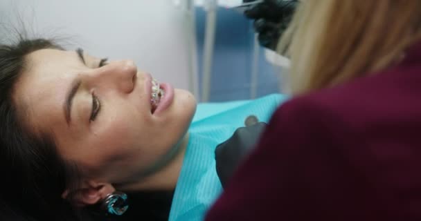 Ein Patient mit Zahnspange liegt in einem Zahnarztstuhl, während er Gummibänder für Zahnspangen trägt. Zahnärztin Kieferorthopädin trägt Gummibänder — Stockvideo