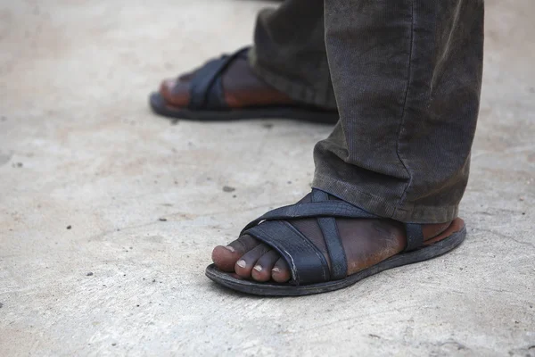 アフリカ人の足 — ストック写真