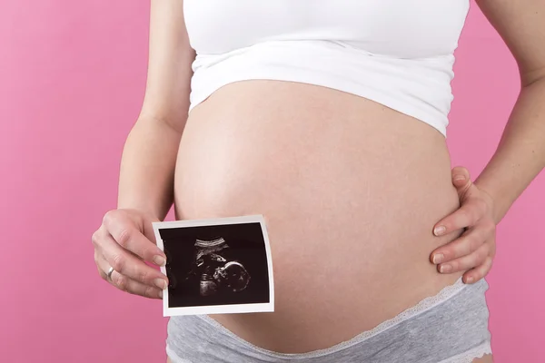 Close-up van een zwangere vrouw met een echografie foto in haar ha — Stockfoto