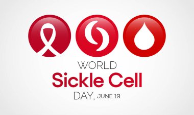 Dünya Orak Hücre Günü her yıl 19 Haziran 'da gözlemlenir. Bu, vücut boyunca oksijen taşımak için yeterli sayıda sağlıklı hücrenin bulunmadığı kalıtsal bir alyuvar hastalığıdır. Vektör illüstrasyonu