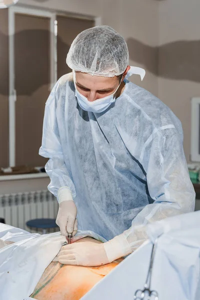 Chirurg Usuwa Tłuszcz Okolicach Pośladków Brzuch Operacja Plastyczna Celu Zmniejszenia — Zdjęcie stockowe