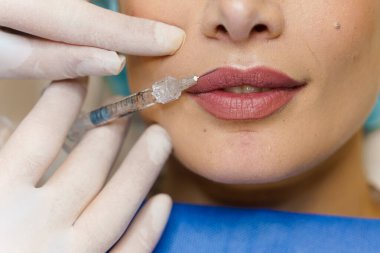 Çekici bir kız için yakın plan dudak büyütme iğneleri. Estetik cerrah tıbbi klinikte dudağına iğne yapar. Kozmetik yenileme yüz tedavisi. Reklam için boş alan