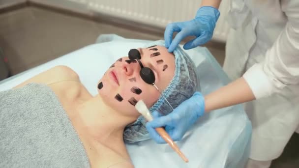 Dermatolog rozmazává černou masku na obličej pro laserovou fotorejuvenaci a odlupování uhlíku. Dermatologie a kosmetologie. Použití chirurgického laseru. — Stock video