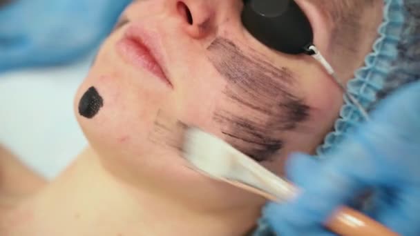 皮膚科医は、レーザー光起光と炭素剥離のために顔に黒いマスクを笑顔.皮膚科と美容学。外科用レーザーを使用. — ストック動画
