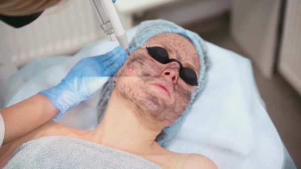 Лазерное фотоомоложение и углеродный пилинг лица для женщины. Черная маска. Дерматология и косметология. Использование хирургического лазера. — стоковое видео