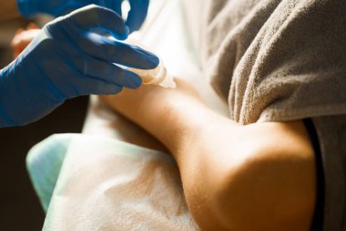 Dış bir antibiyotikle yaranın tedavisi