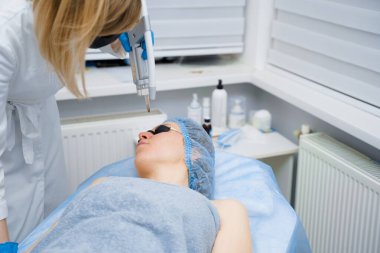 Kadınlar için lazer fotoregenasyon ve karbon soyma. Siyah yüz maskesi. Dermatoloji ve kozmetoloji. Cerrahi lazer kullanarak..