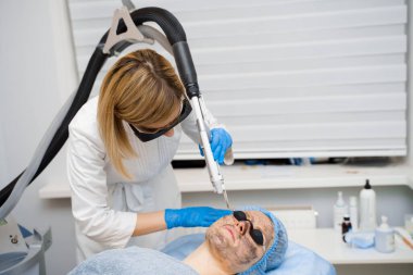 Kadınlar için lazer fotoregenasyon ve karbon soyma. Siyah yüz maskesi. Dermatoloji ve kozmetoloji. Cerrahi lazer kullanarak..