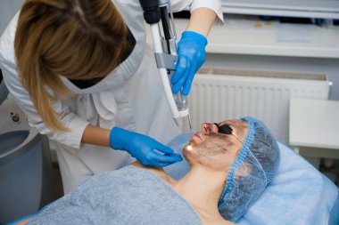Kadınlar için lazer fotoregenasyon ve karbon soyma. Siyah yüz maskesi. Dermatoloji ve kozmetoloji. Cerrahi lazer kullanarak..