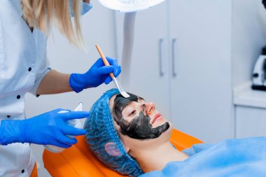Dermatolog yüzüne siyah maske sürüyor lazer fotorejuvenasyon ve karbon soyma için. Dermatoloji ve kozmetoloji. Cerrahi lazer kullanarak..