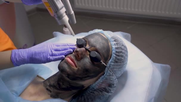 Laser fotorejuvenation en carbon peeling van het gezicht voor de vrouw. Zwart gezichtsmasker. Dermatologie en cosmetologie. Gebruik van chirurgische laser. — Stockvideo