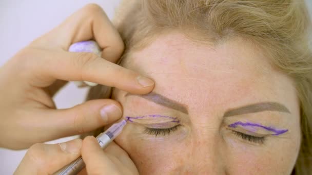 Markah Blepharoplasty close-up di wajah sebelum operasi bedah plastik untuk memodifikasi wilayah mata wajah di klinik medis. Dokter melakukan operasi kosmetik plastik — Stok Video