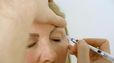 Tıbbi klinikteki yüz bölgesini değiştiren estetik ameliyattan önce yüzünde Blepharoplasti izi var. Estetik ameliyat yapan bir doktor.