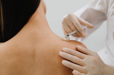 Migren tedavisi için deri hazırlama. Baş ağrısı ve ağrı kesicilerin tedavisi. Doktor tarafından migren tedavisi için işaretli noktalardaki iğneler.