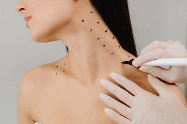 Nefertiti kaldırmadan önce işaretle. Kozmetik uzmanı bir kadının platizmasına botulinyum toksin enjekte edilmeden önce nokta çiziyor. Bir profesyonelden boyun geliştirme. Kadın estetik kozmetolojisi