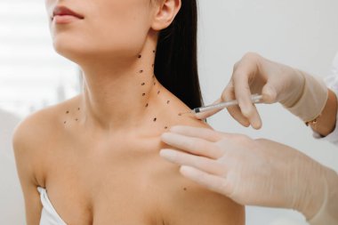 Kozmetik uzmanı kızın platizmasına botulinyum toksin enjekte etmeden önce nokta çiziyor. Nefertiti boyunda işaretli noktalarla enjeksiyonu kaldırıyor.