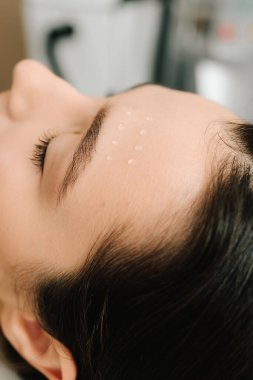 Kozmetik uzmanı kız için yüz terapisi enjeksiyonu yapıyor. Cildi gençleştirmek ve cilt sağlığını ve görünümünü iyileştirmek için yüz mezoterapisi