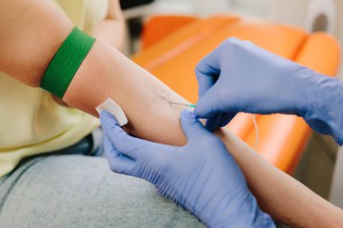 Kan koleksiyonu için bir iğne yerleştir. Steril eldivenli hemşire venipunktur yapar ve kontrollü klinik ortamda tanı testi için kan toplar.