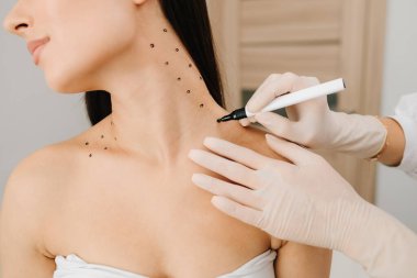 Nefertiti kaldırmadan önce işaretle. Kozmetik uzmanı bir kadının platizmasına botulinyum toksin enjekte edilmeden önce nokta çiziyor. Bir profesyonelden boyun geliştirme. Kadın estetik kozmetolojisi