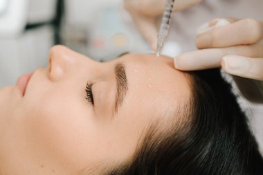 Epidermal nem ve kolajen sentezini arttırmak için Hyaluronik biyoevitalizasyon. Kozmetik uzmanı cilt hidrasyonunu onarmak için hiyalüronik asit kullanarak enjeksiyon biyoevyalizasyonu gerçekleştiriyor.