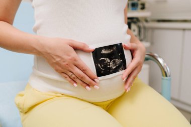 Hamile bir kadın karnında bebeğinin ultrason fotoğrafını taşıyor. Anneliğin değerli anlarını ultrasonla filme alıyorum.