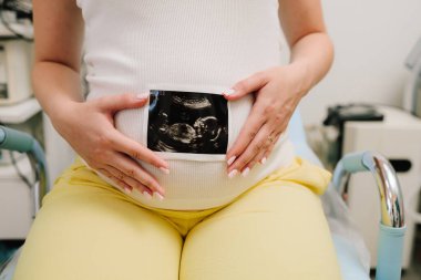 Hamile bir kadın karnında bebeğinin ultrason fotoğrafını taşıyor. Anneliğin değerli anlarını ultrasonla filme alıyorum.